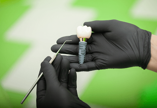What Are 3i Dental Implants?
