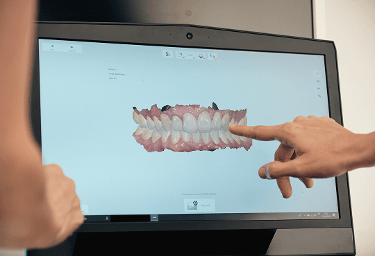 What Is a Dental Crown?