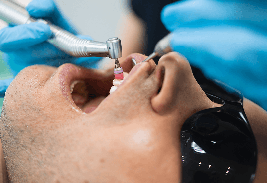 Benefits of Cleanings & Prevention