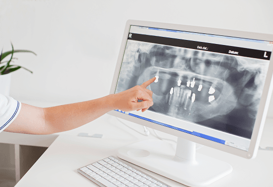 Advanced Digital X-Ray Insights for Better Oral Health