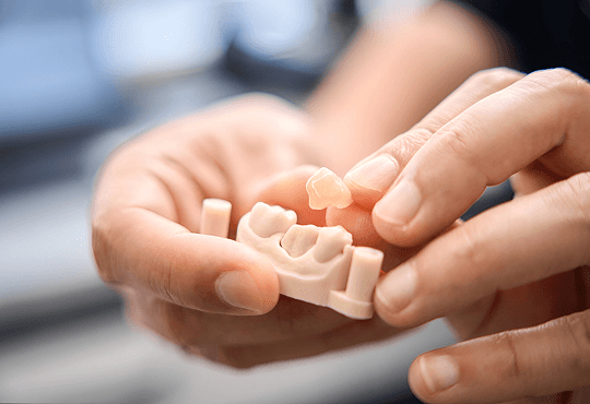 Why Porcelain Crowns Stand Out