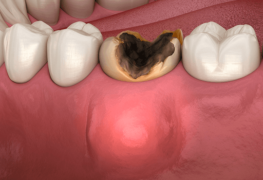 What Is Periodontics?