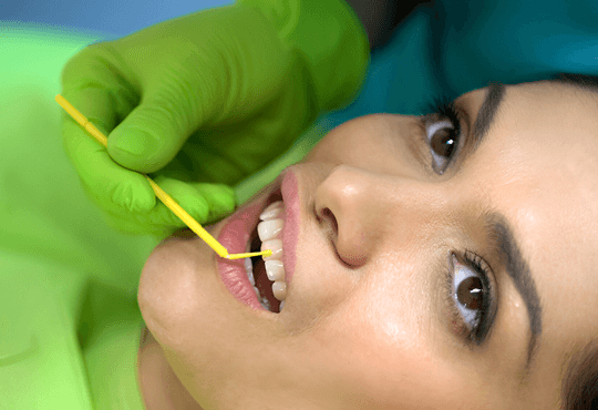 Why Sealants Are Important