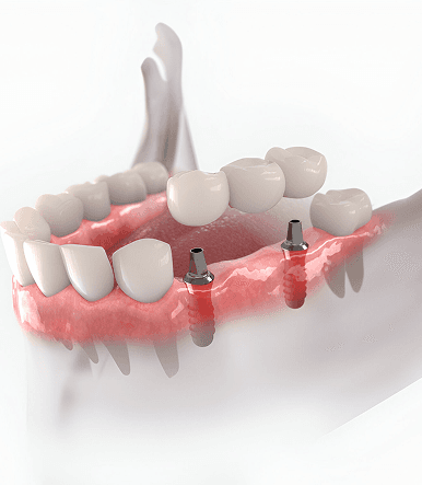 Restorative Dentistry