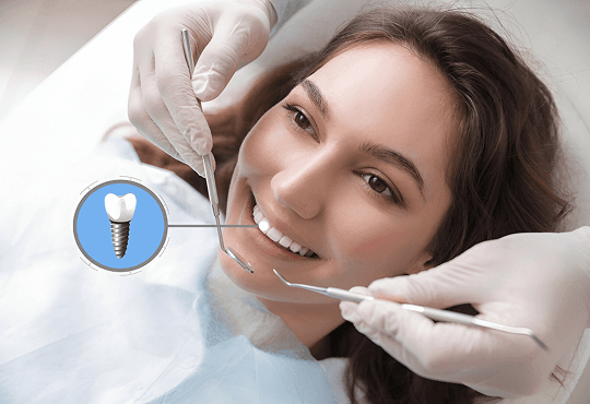 What Are Dental Implants?