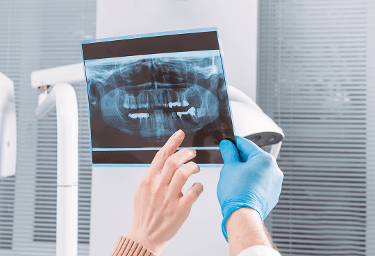 Understanding Dental X-Rays: Essential Diagnostic Tools