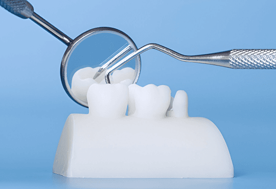 What Are Porcelain Fixed Bridges?