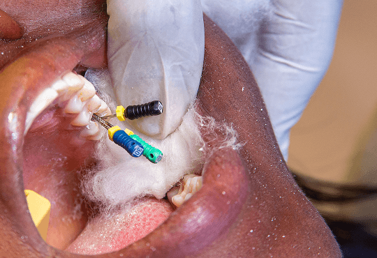 Why Choose Retreatment?