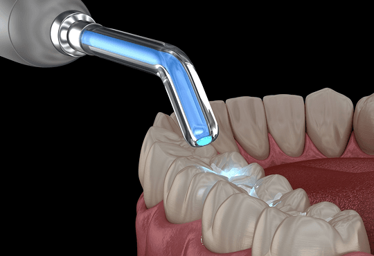 The Role of Restorative Dentistry in Overall Health