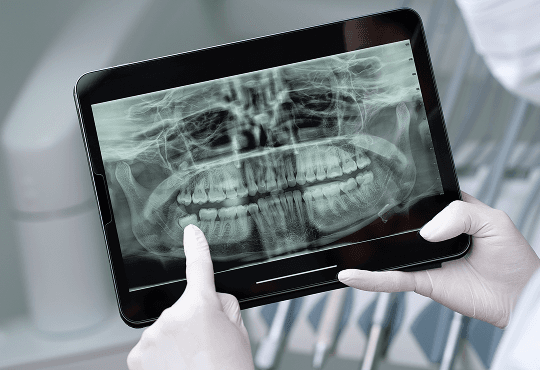 The Modern Edge: Benefits of Digital X-Rays
