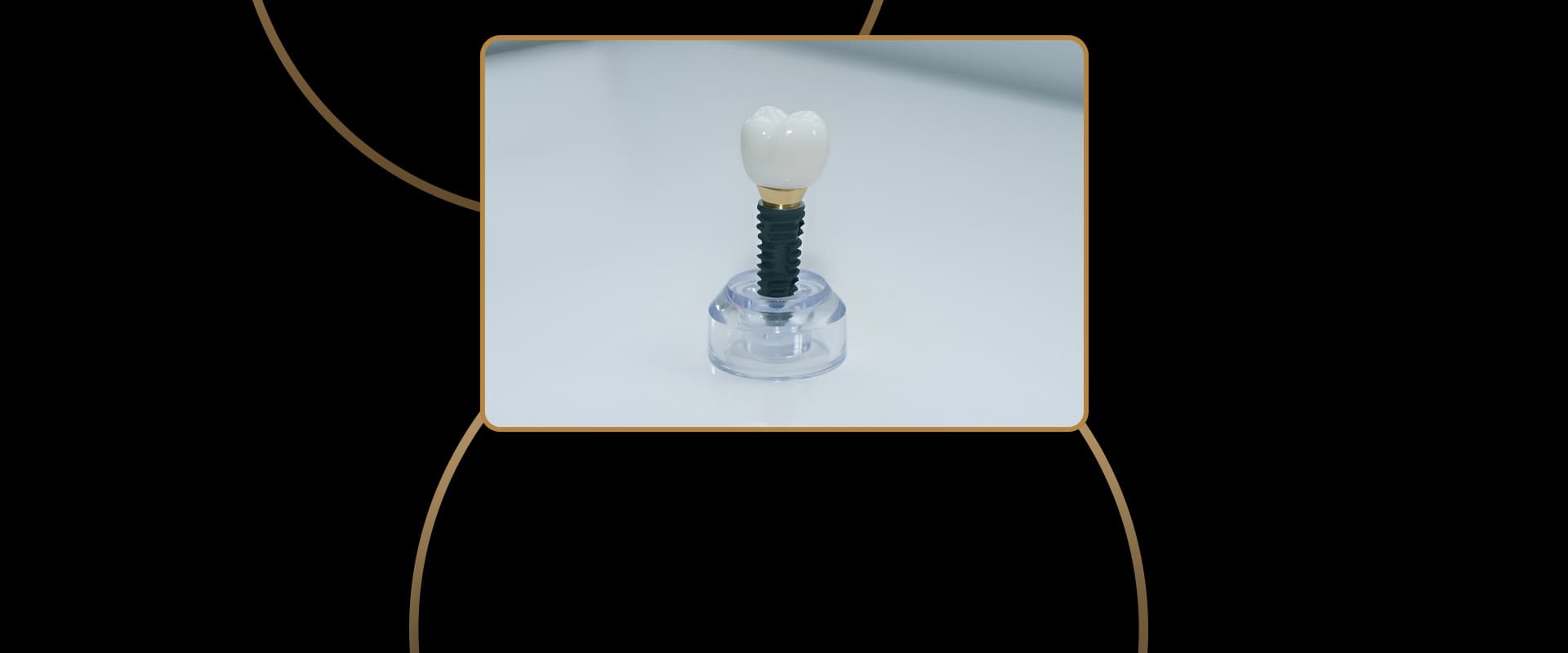 3i Dental Implants