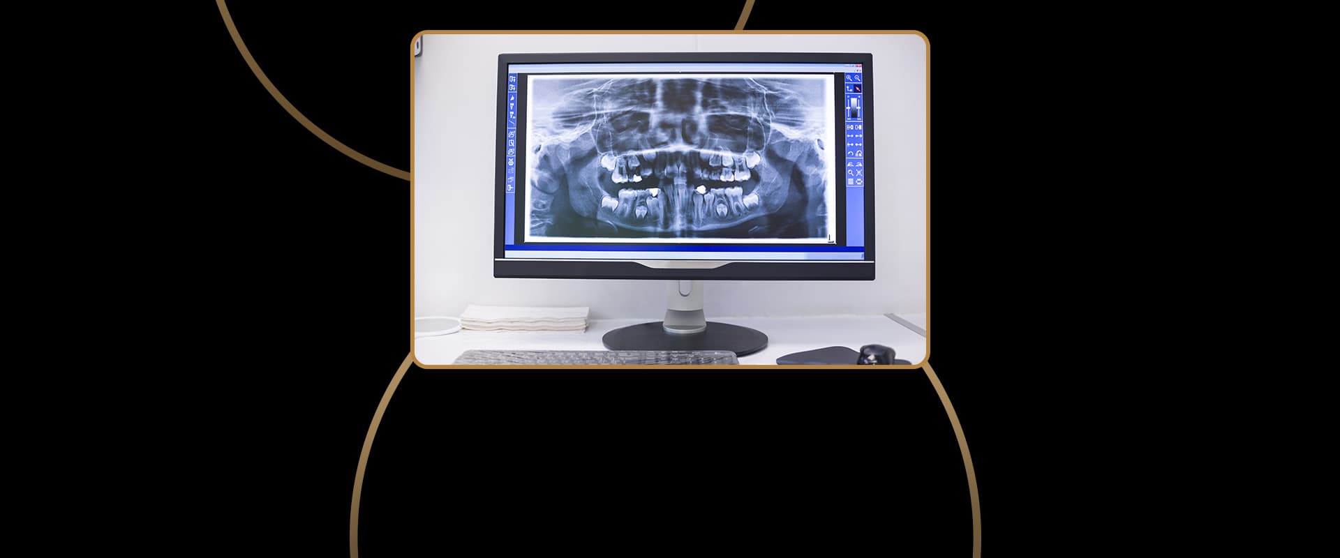 Digital Radiographs