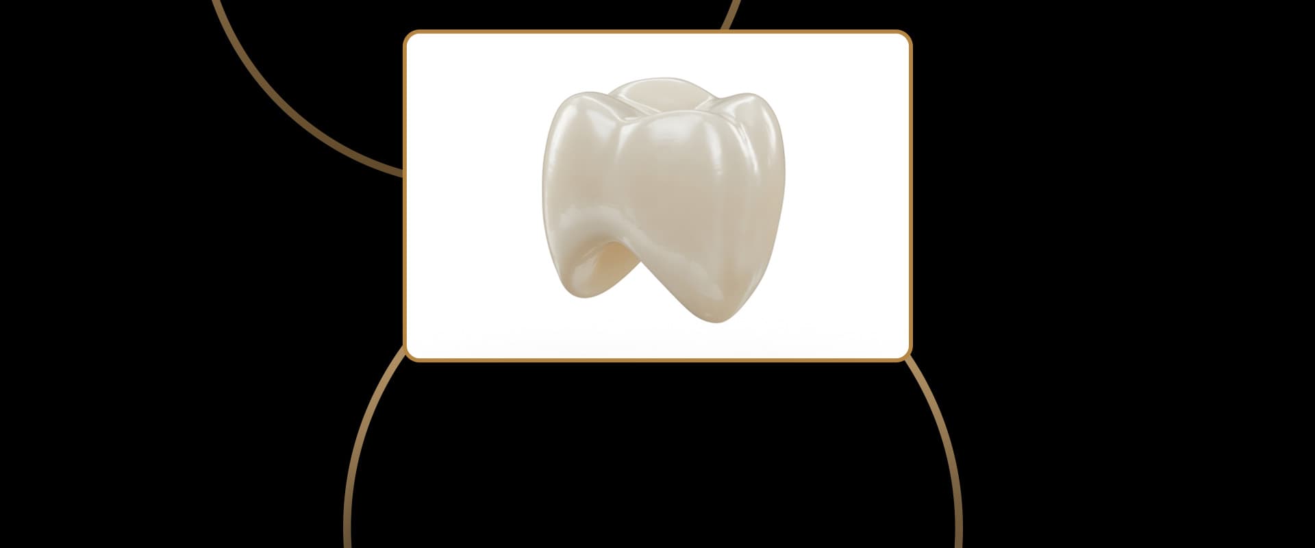 Porcelain Crowns (Caps)