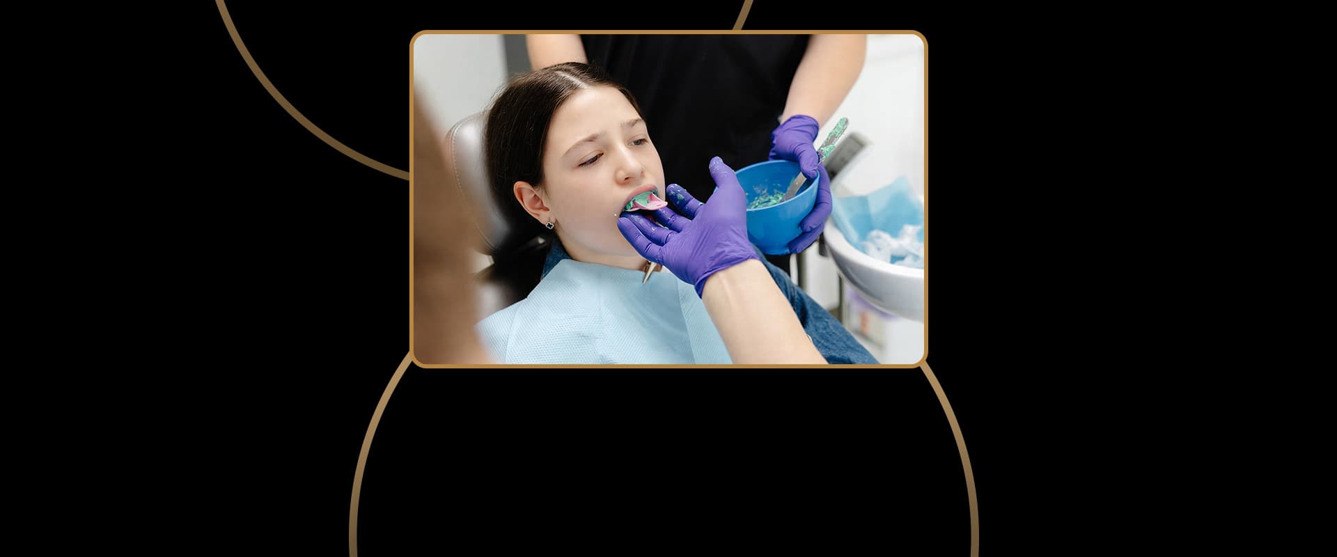 Dental Sealants