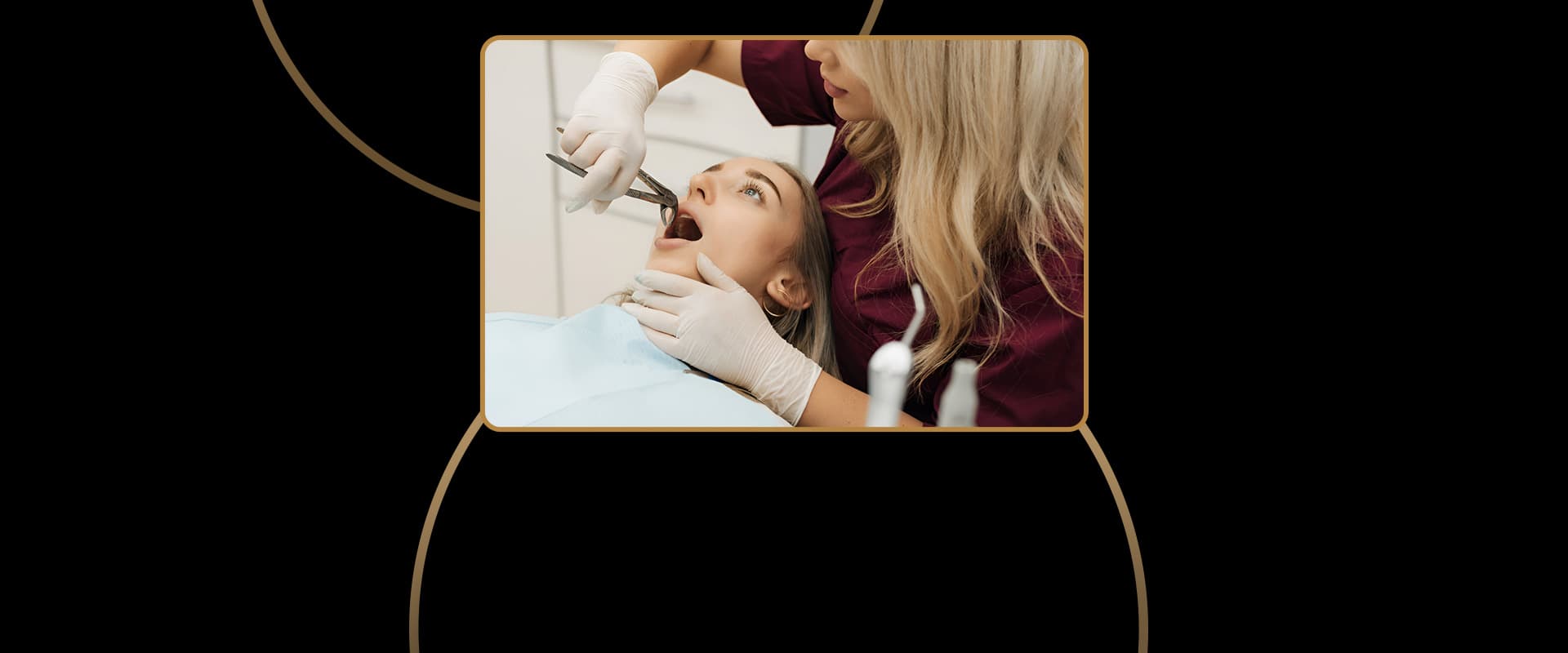 Simple Tooth Extractions