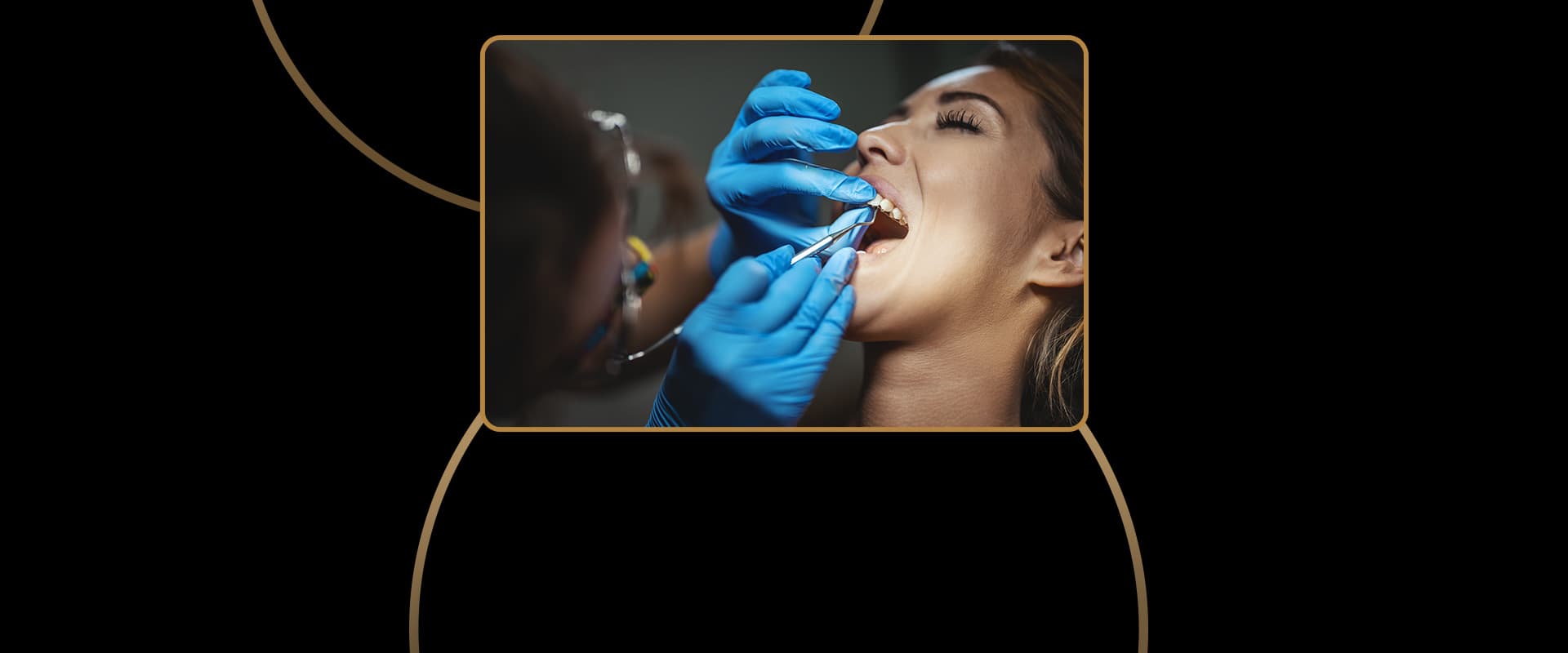 Simple Tooth Extractions