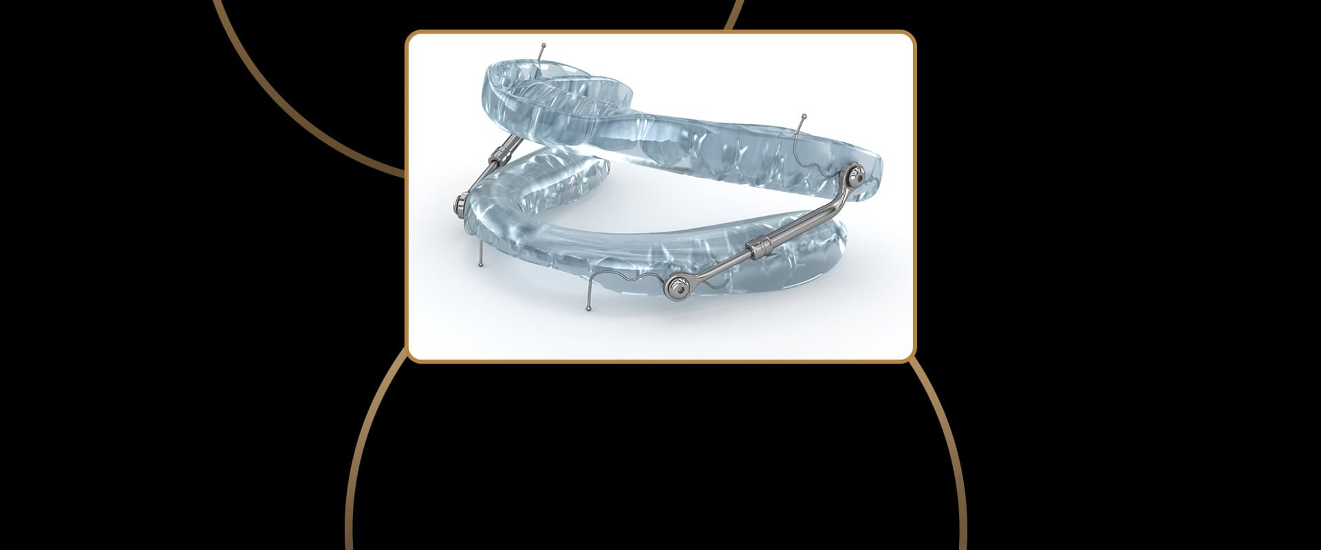 Sleep Apnea Appliances