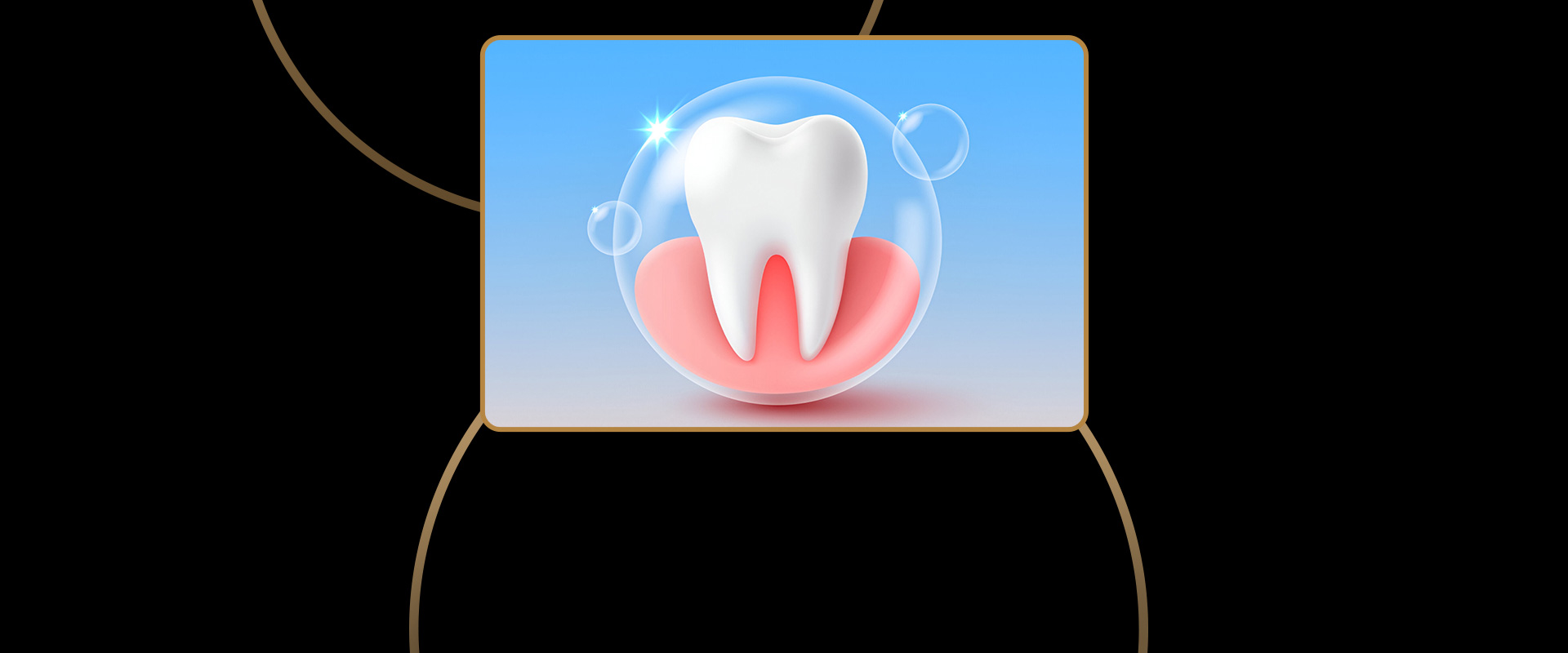 Periodontal Maintenance