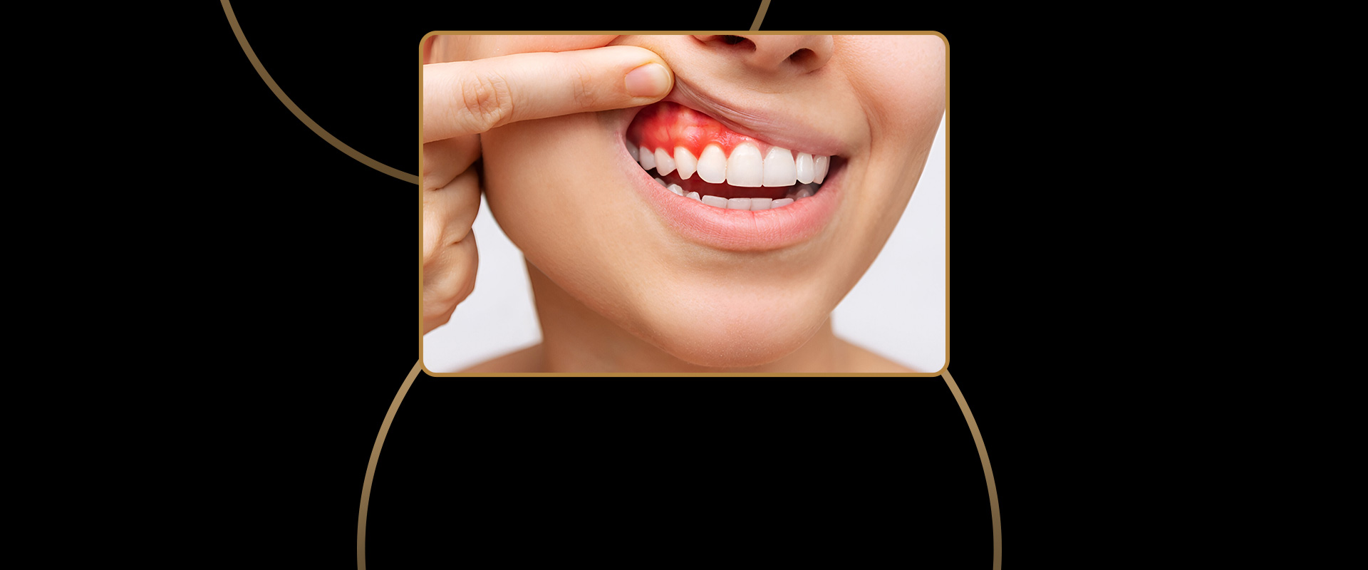 Periodontics