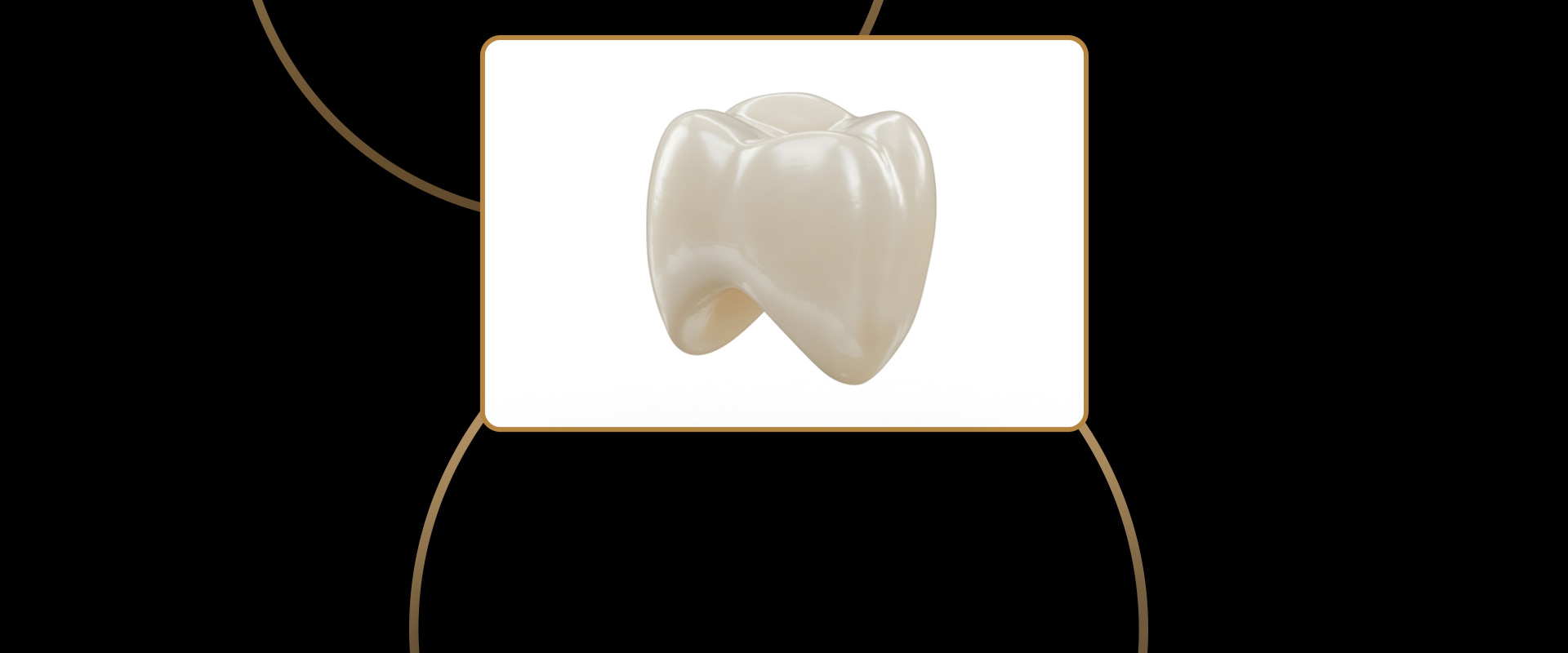 Porcelain Crowns (Caps)