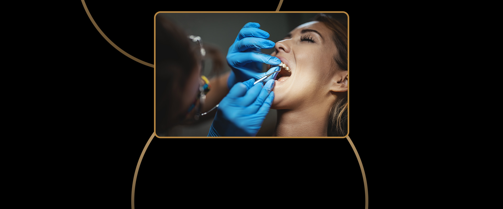 Simple Tooth Extractions