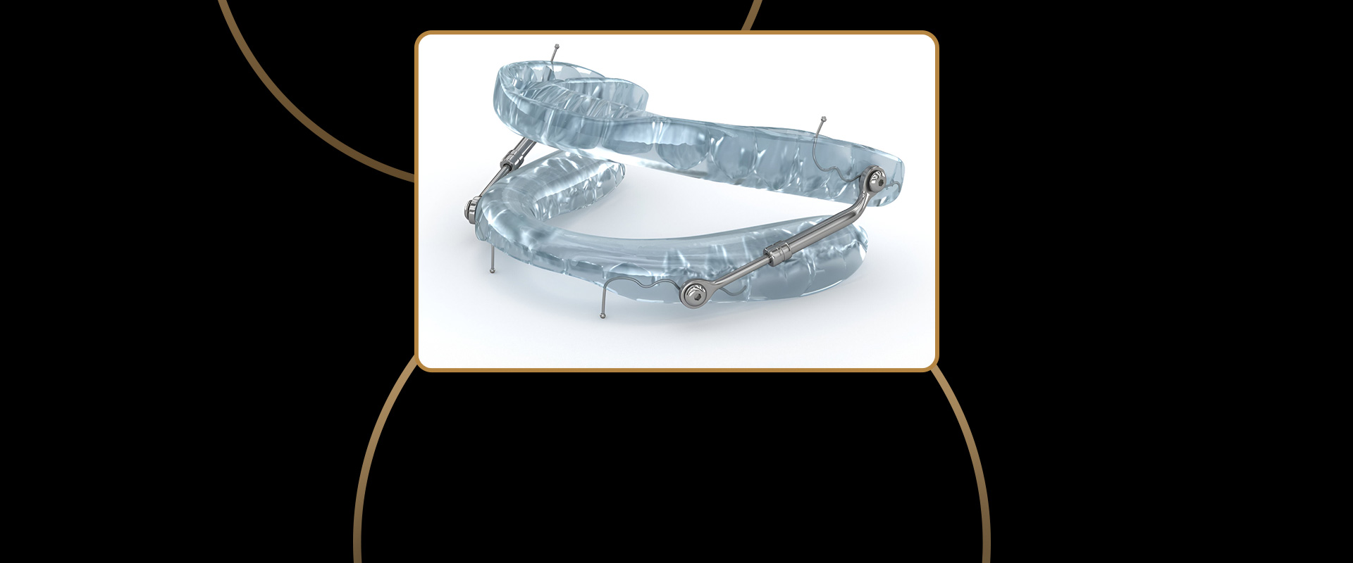 Sleep Apnea Appliances