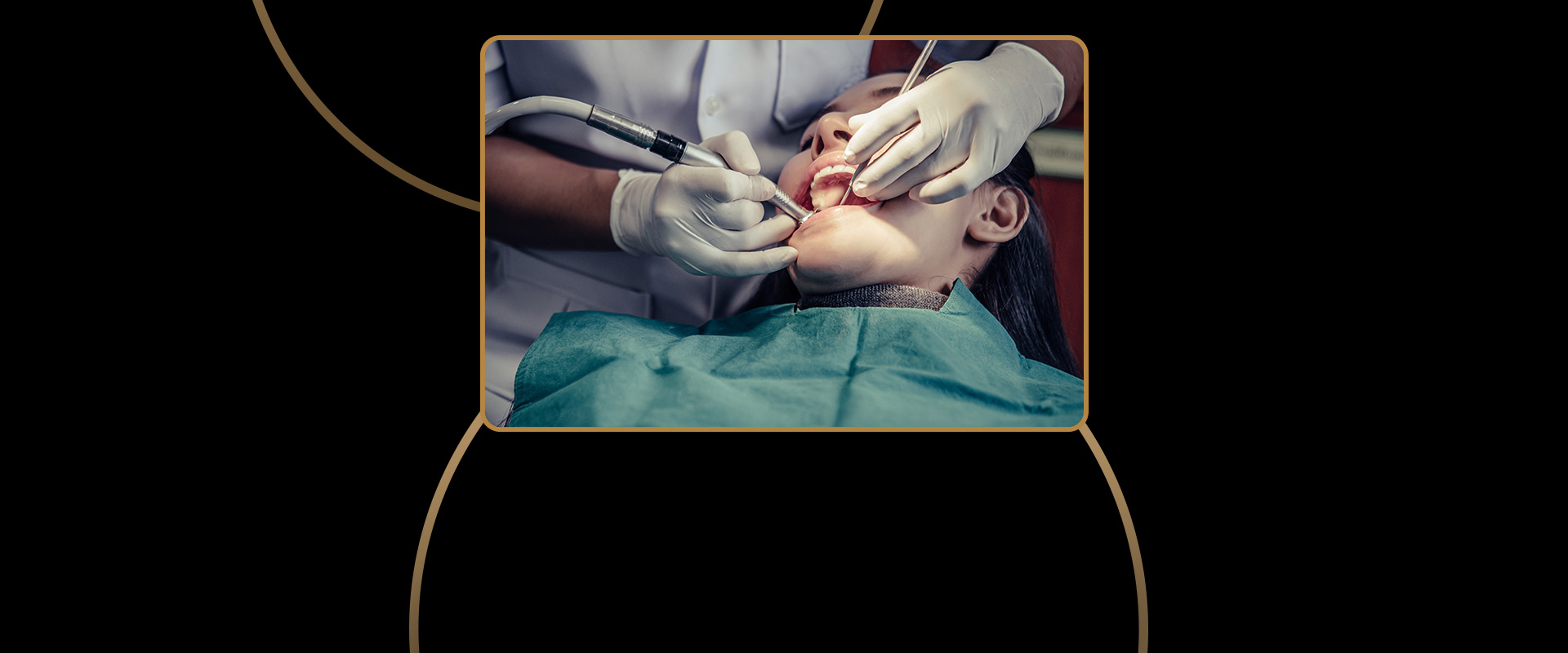 Tooth Extractions
